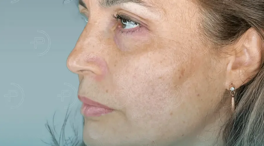 Harmonyca Gençlik Aşısı